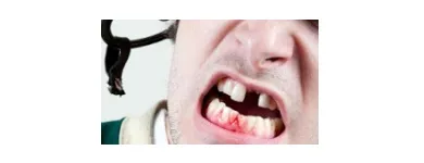 Business 2 image 24 HOUR EMERGENCY DENTISTS LONDON Dentists in London Gr