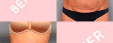 Business 1 image HARLEY STREET COSMETIC SURGERY PARTNERS Plastic & Cosmetic Surgery in London Gr