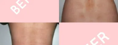 Business 5 image HARLEY STREET COSMETIC SURGERY PARTNERS Plastic & Cosmetic Surgery in London Gr