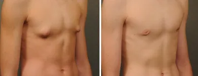 Business 6 image HARLEY STREET COSMETIC SURGERY PARTNERS Plastic & Cosmetic Surgery in London Gr