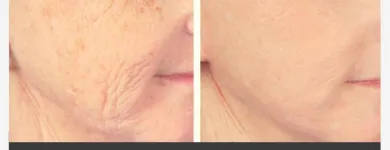 Business 8 image HARLEY STREET COSMETIC SURGERY PARTNERS Plastic & Cosmetic Surgery in London Gr