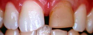 Business 4 image WHITESTAR DENTAL PRACTICE Dentists in Harrow Mi