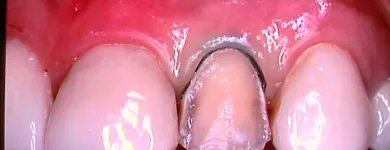 Business 7 image WHITESTAR DENTAL PRACTICE Dentists in Harrow Mi