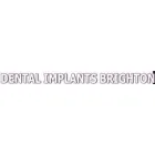DENTAL IMPLANTS BRIGHTON